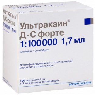 Ультракаїн Д-С форте картридж 1.7 мл №100 - 1